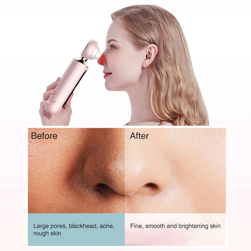 Nissa™ Blackhead Suction Machine