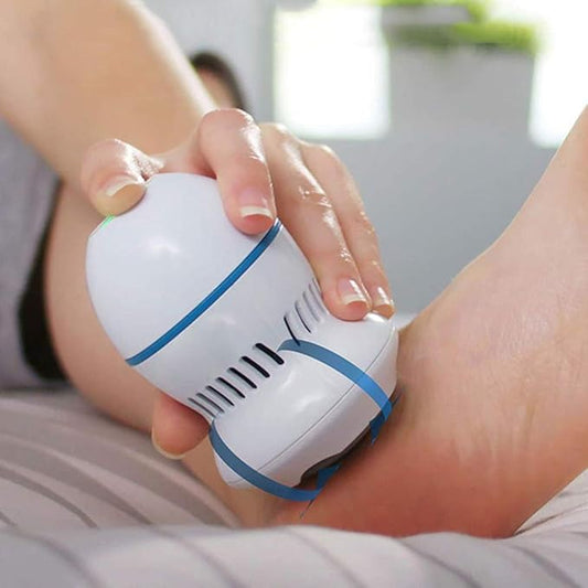 Nissa™Electric Callus Remover – مزيل الجلد الميت الكهربائي