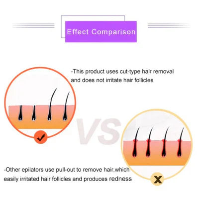 Nissa™Purple Epilator – آلة إزالة الشعر البنفسجية