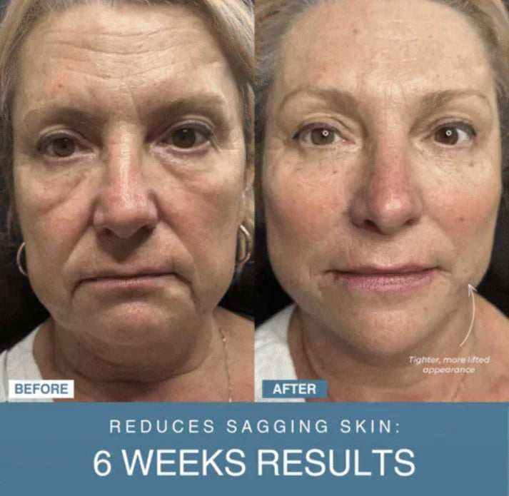 Nissa™ 7-in-1 LED Anti-Aging/Wrinkle Apparatus   جهاز 7 في 1 LED لمكافحة التجاعيد ومقاومة الشيخوخة