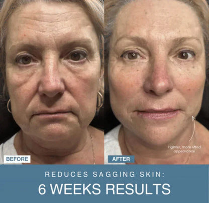 Nissa™ 7-in-1 LED Anti-Aging/Wrinkle Apparatus   جهاز 7 في 1 LED لمكافحة التجاعيد ومقاومة الشيخوخة