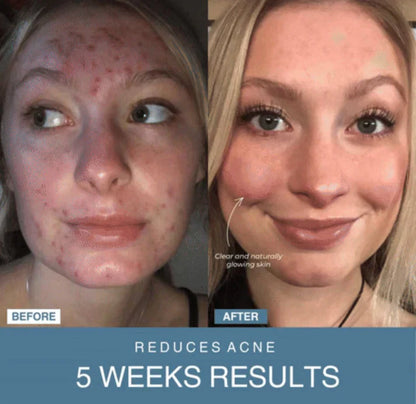 Nissa™ 7-in-1 LED Anti-Aging/Wrinkle Apparatus   جهاز 7 في 1 LED لمكافحة التجاعيد ومقاومة الشيخوخة