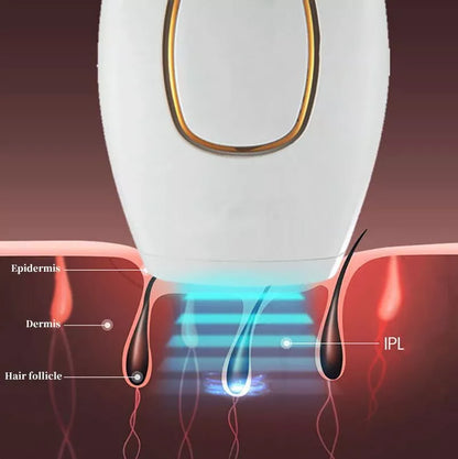 Nissa™ IPL Laser Hair Removal – جهاز إزالة الشعر بالليزر IPL